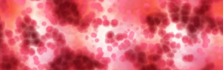 Autoimmunerkrankungen